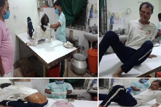 Tripura's 'Saddam' Biplab Deb's direct threat against Medias resulted in brutal attack on Journalist Parashar Biswas : Journalist's Live Video against Biplab resulted in brutal attack on Saturday night Tripura's 'Saddam' Biplab Deb's direct threat against Medias resulted in brutal attack on Journalist Parashar Biswas : Journalist's Live Video against Biplab resulted in brutal attack on Saturday night